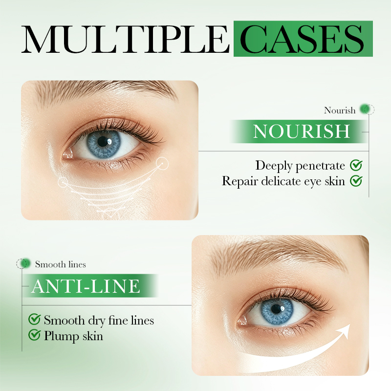 60pcs SADOER Centella Asiatica - Collagen Under Eye Patches recension och pris